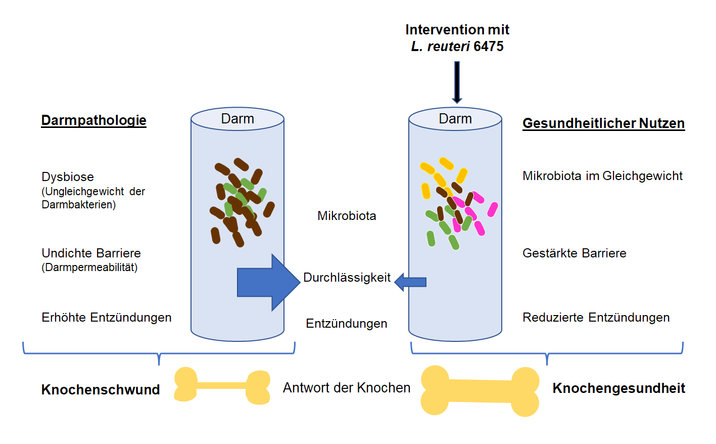 Zusammenhang zwischen Darmpermeabilität und Knochenverlust