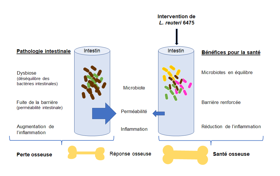 Lien entre la perméabilité intestinale et la perte osseuse