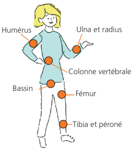 Lieux fréquents touchés par les fractures dans l'ostéoporose