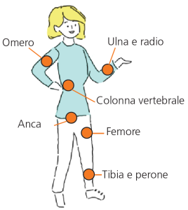 Luoghi frequenti di fratture nell'osteoporosi